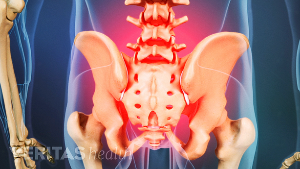 Medical illustration of the posterior side of the pelvis. The sacrum is highlighted in red to indicate pain, numbness or tingling.