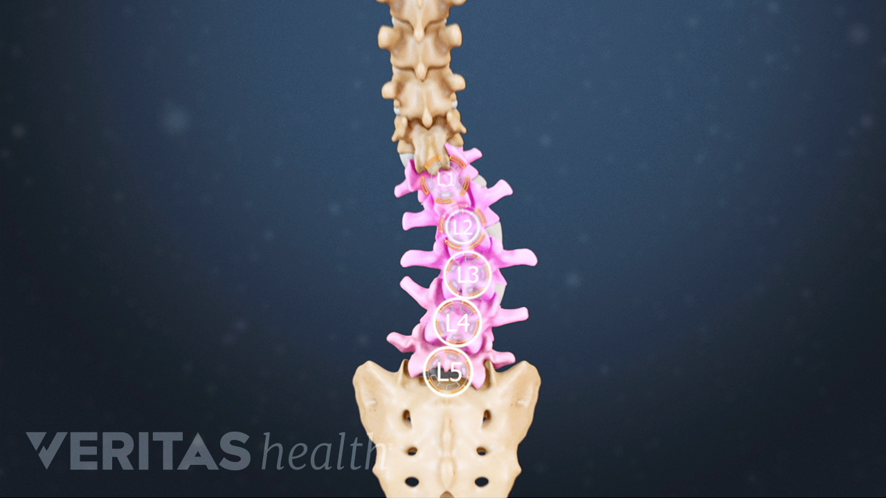 Types Of Scoliosis | Spine-health