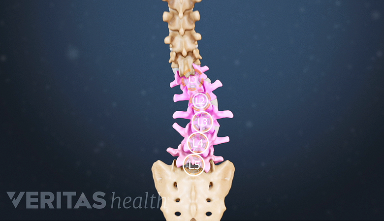 Illustration showing a curved spine with lumbar vertebrae highlighted in pink.