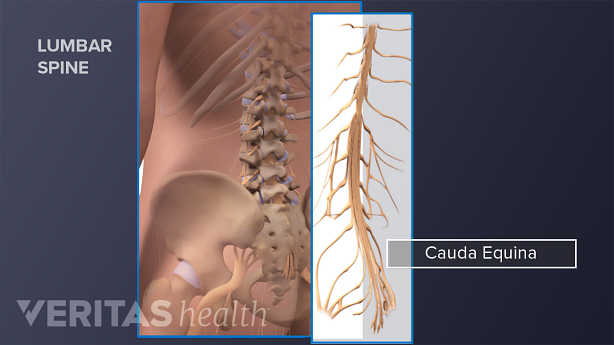 The lower back and pelvic bones along with the spinal cord and cauda equina.