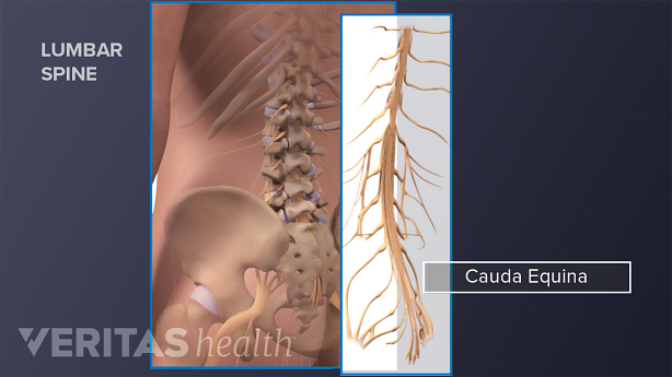 the adult spine, spinal cord, and cauda equina.