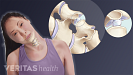 Medical illustration of the gas bubbles within the cervical facet joints that lead to crepitus