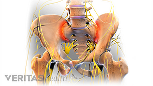 Pelvic bones with SI-Joint highlighted in red