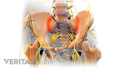 Pelvic bones with SI-Joint highlighted in red