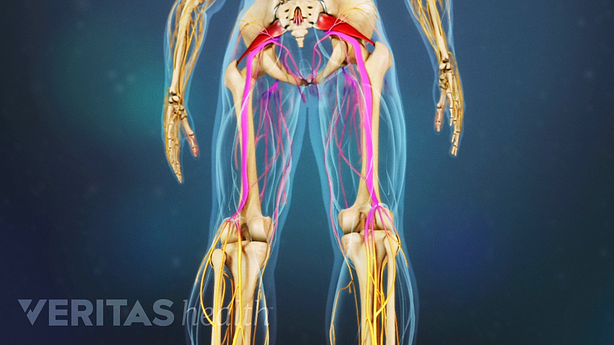 Nerve pain in both legs.
