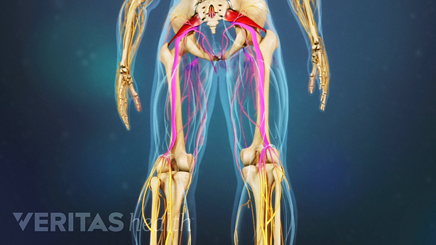Medical illustration of a posterior view of the legs. The sciatic nerve is highlighted in red, indicating pain, numbness or tingling.