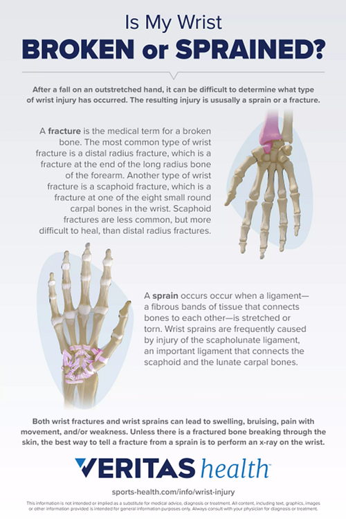 Infographic of Is my Wrist Broken or Sprained