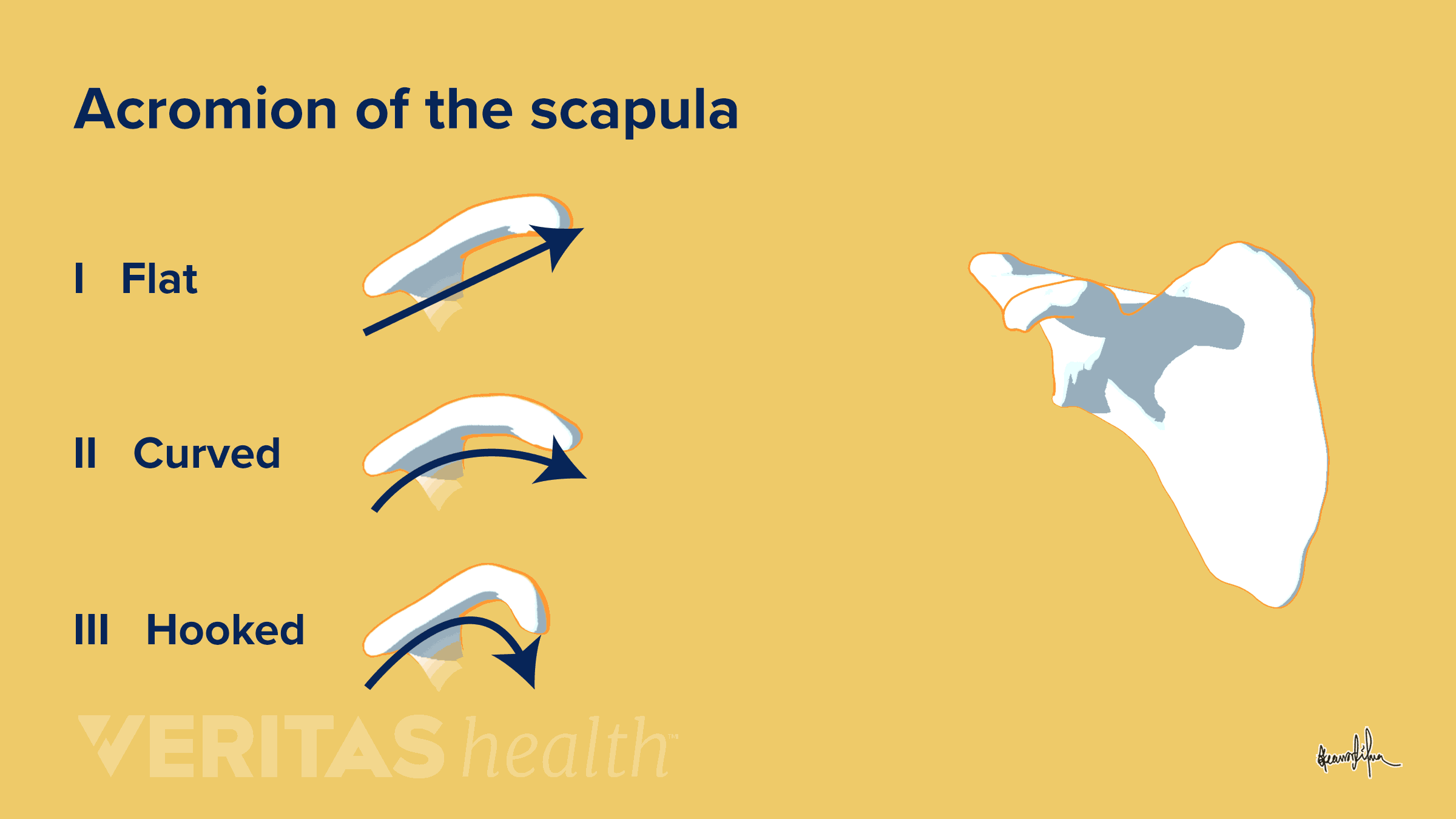 Animation showing the different shapes of the acromion