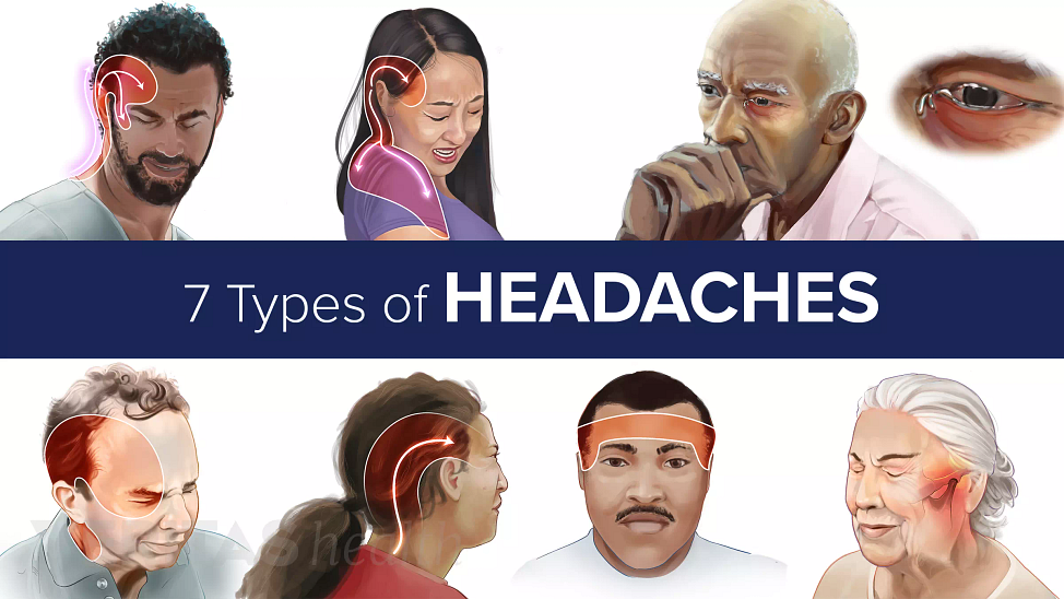 7 Types of Headaches stemming from a neck problem are usually chronic and vary in type depending on the cause.