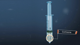 Medical illustration of a cortisone injection syringe.