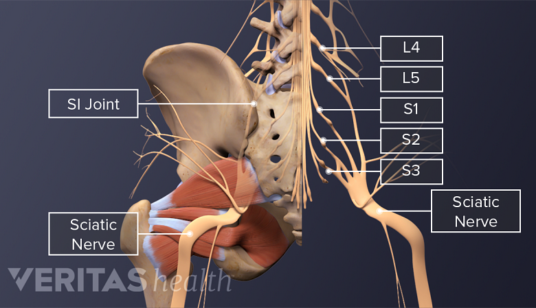 Ilustración de los nervios espinales lumbares y el nervio ciático.