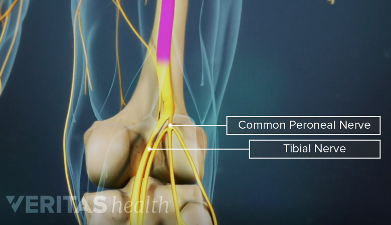 Illustration showing the knee joint with peroneal and tibial nerve.