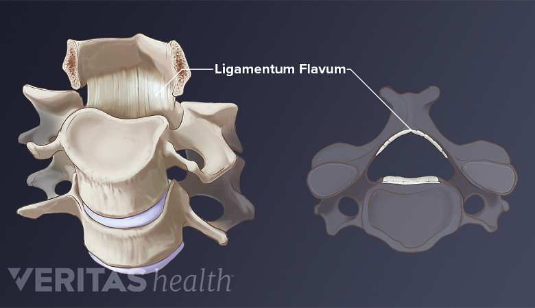 Illustration of the ligamentum flava