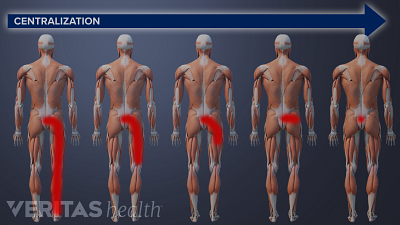 Do you have good posture? - Mayo Clinic Health System