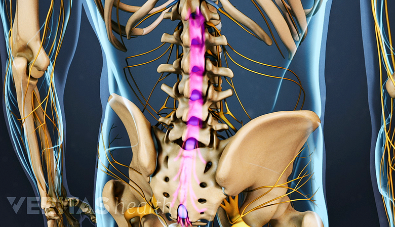 Illustration of the lower back anatomy of a human. Highlighting the nerves in the lumbar spine that make up the cauda equina.