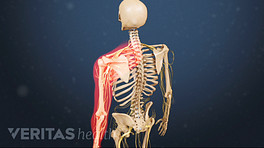 Medical illustration of a skeleton. The left arm and shoulder are highlighted in red, indicating pain, numbness or tingling.