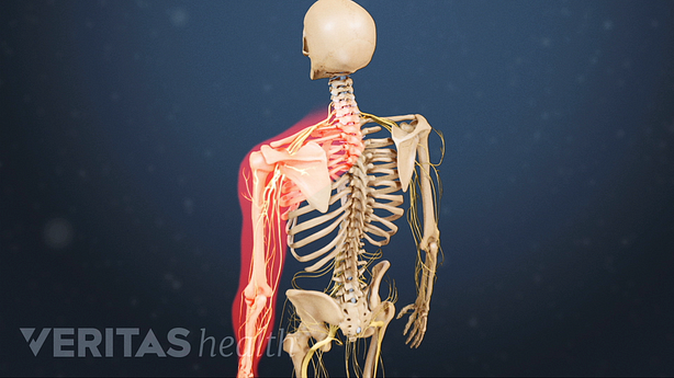 An illustration showing upper limb highlighted in red.