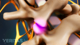 Medical illustration close up view of facet joints in the lumbar spine