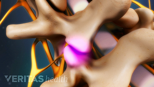 Medical illustration close up view of facet joints in the lumbar spine