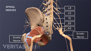 Ilustración médica de la columna lumbar. El músculo piriforme, el nervio ciático y los nervios espinales L4, L5, S1, S2 y S3 están etiquetados.