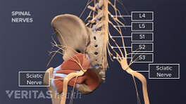 Medical illustration of the lumbar spine. The piriformis muscle, sciatic nerve, and spinal nerves L4, L5, S1, S2, and S3 are labeled.