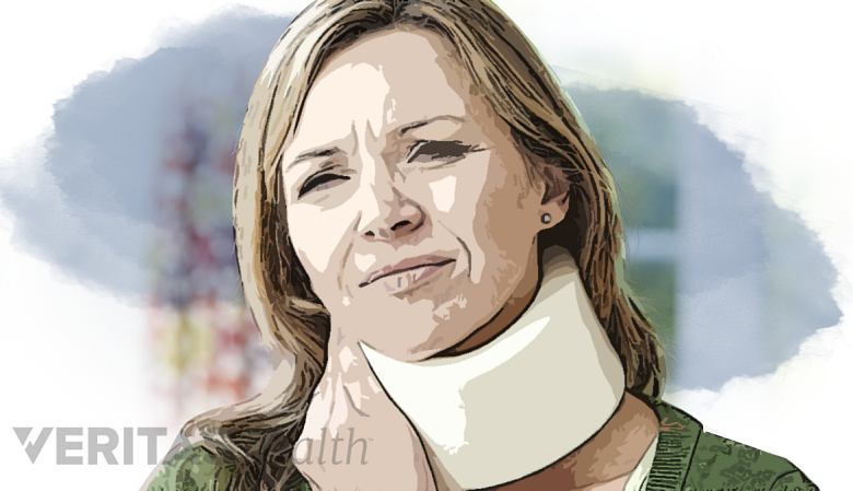Filtered photo of a woman with a neck brace grabbing her neck with a pained expression.