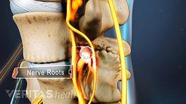 Profile view of the nerve root between two vertebrae