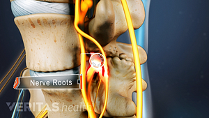 Vista de perfil de la raíz nerviosa entre dos vértebras