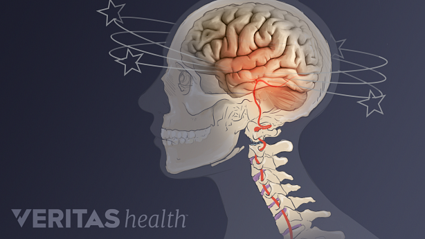 Illustration showing a skeleton showing dizziness.