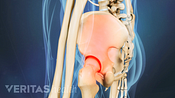 Profile view of SI joint pain in the pelvis.