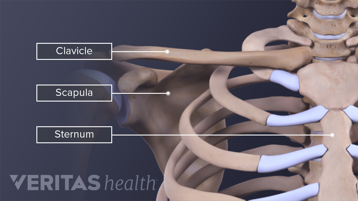 Surgery For Clavicle Fracture (Broken Collarbone) | Sports-health