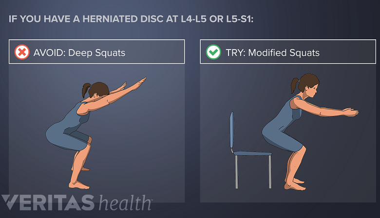 Avoid deep squats with L4-L5 or L5-S1 disc herniation. Try Modified squats.